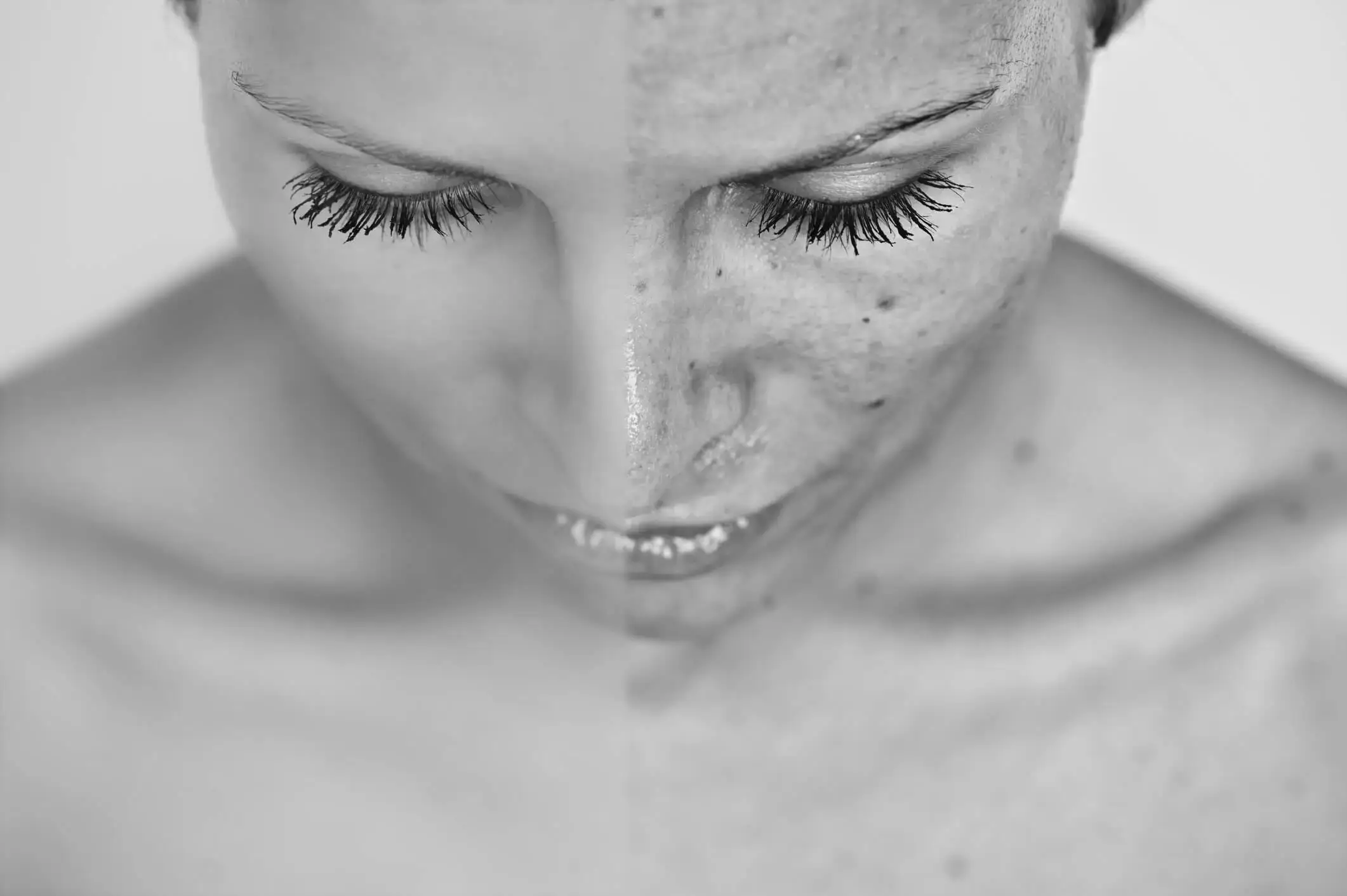 Resultaten van pigmentatiebehandeling gezicht