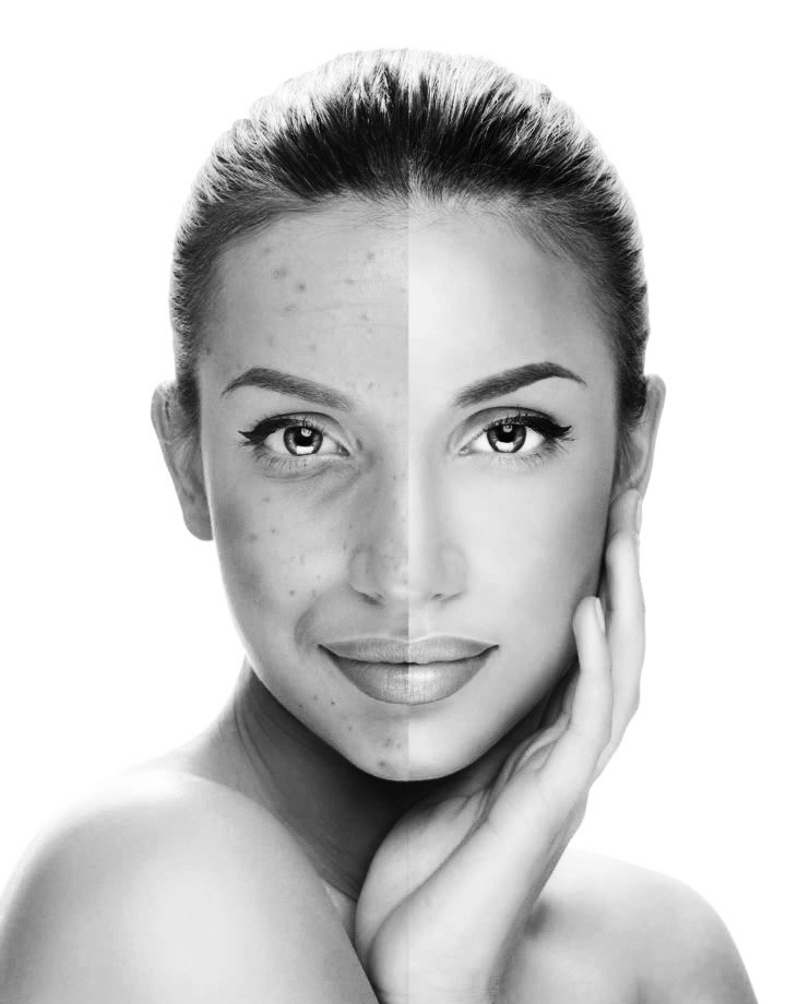 Gezichtsbehandeling bij MED-CLINIC